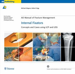 buecher AO Manual of Fracture Management: Internal Fixators (eBook ePUB) von Michael Wagner; Robert Frigg - bücher.de