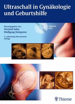 buecher Ultraschall in Gynäkologie und Geburtshilfe (eBook PDF) - bücher.de
