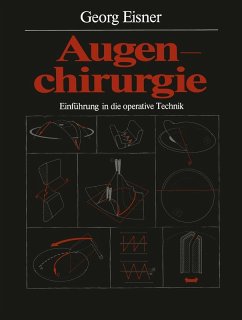 buecher Augenchirurgie (eBook PDF) von Georg Eisner - bücher.de Exklusive Angebote